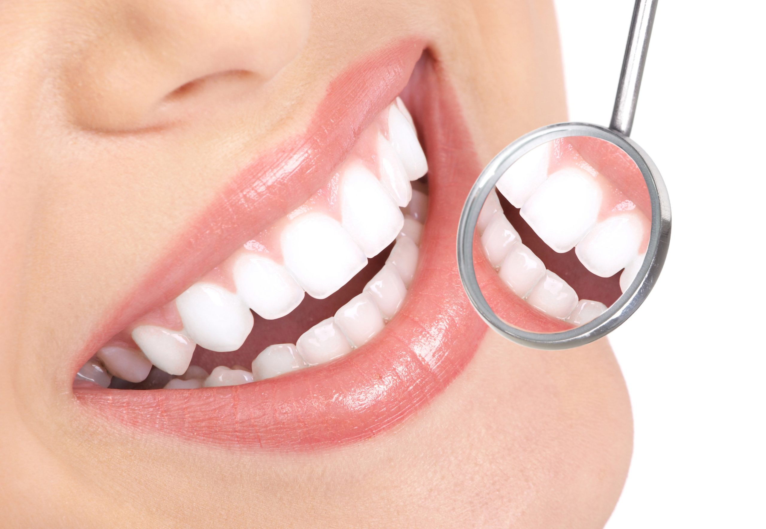 Myths and Facts About Teeth Whitening